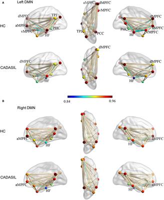 Altered Default Mode Network Is Associated With Cognitive Impairment in CADASIL as Revealed by Multimodal Neuroimaging